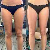 Ziharo™ - Anti-Cellulite Massager